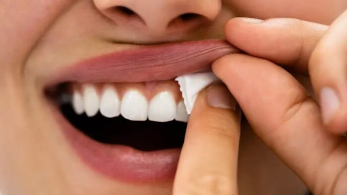 Nikotinske kesice se stavljaju izmedju usne i zuba