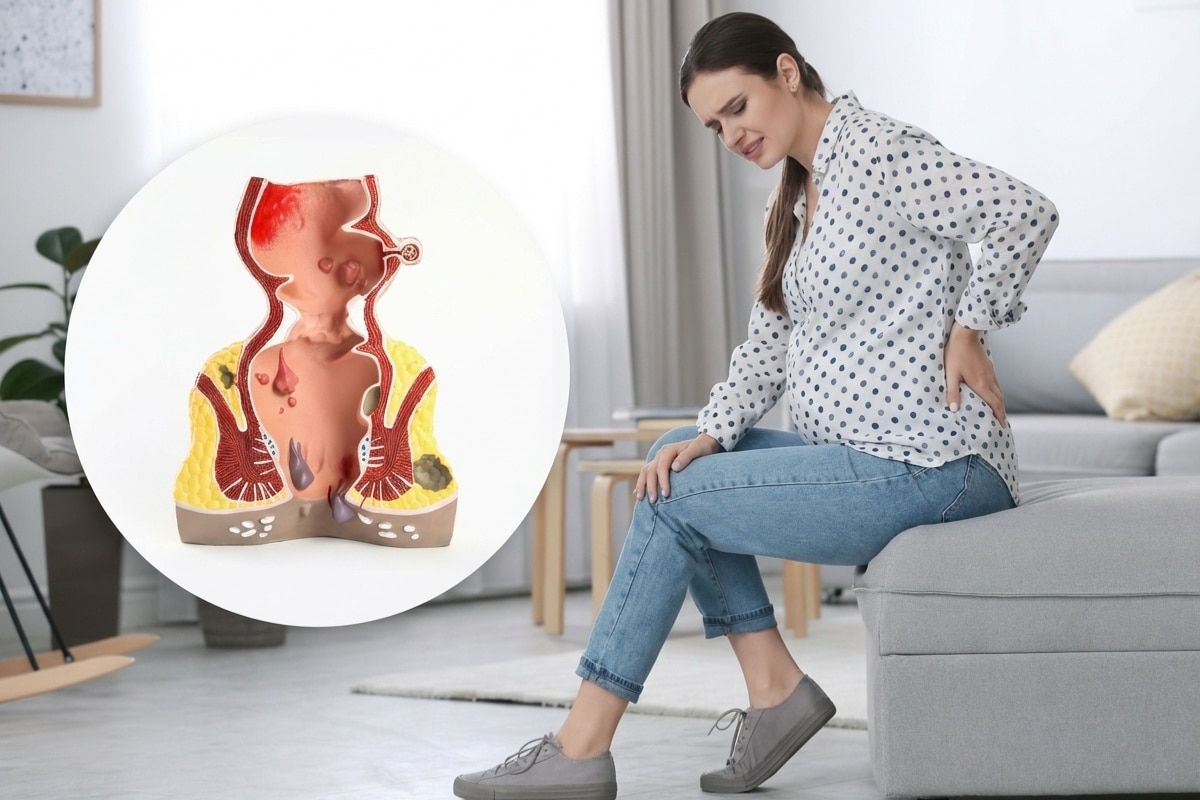 prikaz trudnice koja se drži za leđa od bola, problem sa hemoroidima